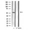 DF3438 staining  Hela cells by IF/ICC. The sample were fixed with PFA and permeabilized in 0.1% Triton X-100,then blocked in 10% serum for 45 minutes at 25¡ãC. The primary antibody was diluted at 1/200 and incubated with the sample for 1 hour at 37¡ãC. An  Alexa Fluor 594 conjugated goat anti-rabbit IgG (H+L) antibody(Cat.# S0006), diluted at 1/600, was used as secondary antibod