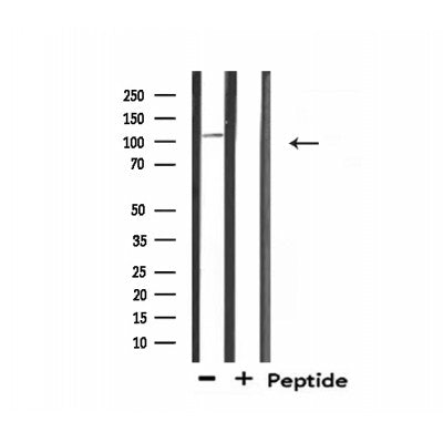 Western blot analysis of extracts from 293, using MED24 Antibody.