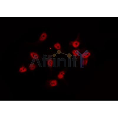 Western blot analysis of extracts from rat lung, using BCA3 Antibody.