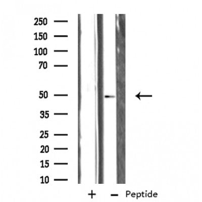 DF3446 staining  HepG2 cells by IF/ICC. The sample were fixed with PFA and permeabilized in 0.1% Triton X-100,then blocked in 10% serum for 45 minutes at 25¡ãC. The primary antibody was diluted at 1/200 and incubated with the sample for 1 hour at 37¡ãC. An  Alexa Fluor 594 conjugated goat anti-rabbit IgG (H+L) antibody(Cat.