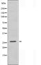 DF3447 staining RAW264.7 by IF/ICC. The sample were fixed with PFA and permeabilized in 0.1% Triton X-100,then blocked in 10% serum for 45 minutes at 25¡ãC. The primary antibody was diluted at 1/200 and incubated with the sample for 1 hour at 37¡ãC. An  Alexa Fluor 594 conjugated goat anti-rabbit IgG (H+L) Ab, diluted at 1/600, was used as the secondary antibod