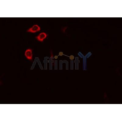 Western blot analysis of extracts from HepG2,mouse brain, using IARS2 Antibody.