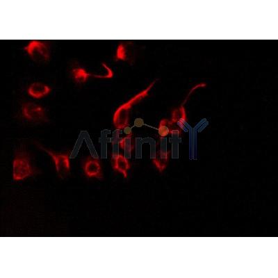 Western blot analysis of extracts from HepG2, using AATF Antibody.