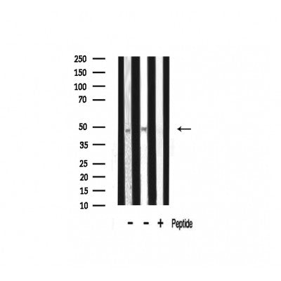 Western blot analysis of ADA2L expression in various lysates