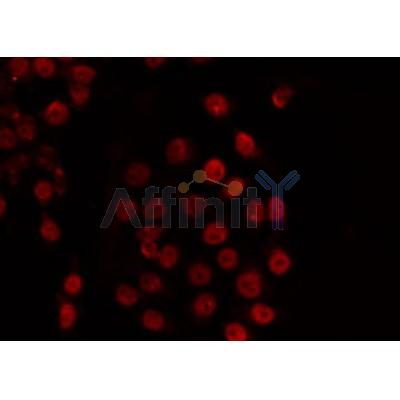 AF0347 staining COS7 by IF/ICC. The sample were fixed with PFA and permeabilized in 0.1% Triton X-100,then blocked in 10% serum for 45 minutes at 25¡ãC. The primary antibody was diluted at 1/200 and incubated with the sample for 1 hour at 37¡ãC. An  Alexa Fluor 594 conjugated goat anti-rabbit IgG (H+L) Ab, diluted at 1/600, was used as the secondary antibod