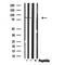 Western blot analysis of MARK expression in various lysates
