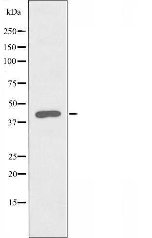 DF3460 staining HeLa by IF/ICC. The sample were fixed with PFA and permeabilized in 0.1% Triton X-100,then blocked in 10% serum for 45 minutes at 25¡ãC. The primary antibody was diluted at 1/200 and incubated with the sample for 1 hour at 37¡ãC. An  Alexa Fluor 594 conjugated goat anti-rabbit IgG (H+L) Ab, diluted at 1/600, was used as the secondary antibod