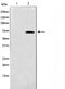 Western blot analysis on HT29 cell lysate using TAF5L Antibody,The lane on the left is treated with the antigen-specific peptide.
