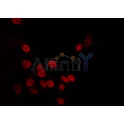 AF0348 staining HT29 by IF/ICC. The sample were fixed with PFA and permeabilized in 0.1% Triton X-100,then blocked in 10% serum for 45 minutes at 25¡ãC. The primary antibody was diluted at 1/200 and incubated with the sample for 1 hour at 37¡ãC. An  Alexa Fluor 594 conjugated goat anti-rabbit IgG (H+L) Ab, diluted at 1/600, was used as the secondary antibod