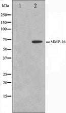 Western blot analysis on HepG2 cell lysate using MMP16 Antibody. The lane on the left is treated with the antigen-specific peptide.