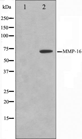 Western blot analysis on HepG2 cell lysate using MMP16 Antibody. The lane on the left is treated with the antigen-specific peptide.