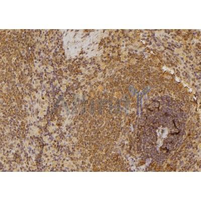 DF3464 staining U87 by IF/ICC. The sample were fixed with PFA and permeabilized in 0.1% Triton X-100,then blocked in 10% serum for 45 minutes at 25¡ãC. The primary antibody was diluted at 1/200 and incubated with the sample for 1 hour at 37¡ãC. An  Alexa Fluor 594 conjugated goat anti-rabbit IgG (H+L) Ab, diluted at 1/600, was used as the secondary antibod