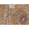 DF3464 staining U87 by IF/ICC. The sample were fixed with PFA and permeabilized in 0.1% Triton X-100,then blocked in 10% serum for 45 minutes at 25¡ãC. The primary antibody was diluted at 1/200 and incubated with the sample for 1 hour at 37¡ãC. An  Alexa Fluor 594 conjugated goat anti-rabbit IgG (H+L) Ab, diluted at 1/600, was used as the secondary antibod