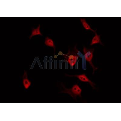 Western blot analysis of extracts from mouse brain, using ZC3H7B Antibody.