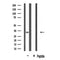 DF3466 staining  LOVO cells by IF/ICC. The sample were fixed with PFA and permeabilized in 0.1% Triton X-100,then blocked in 10% serum for 45 minutes at 25¡ãC. The primary antibody was diluted at 1/200 and incubated with the sample for 1 hour at 37¡ãC. An  Alexa Fluor 594 conjugated goat anti-rabbit IgG (H+L) antibody(Cat.# S0006), diluted at 1/600, was used as secondary antibod