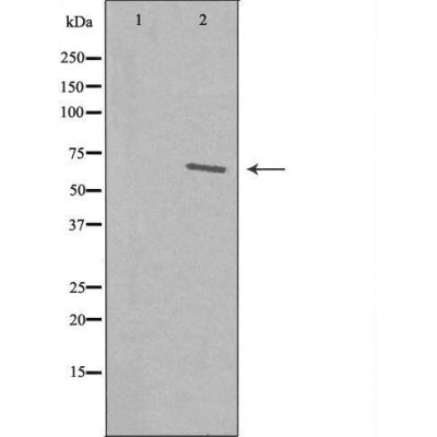 DF3472 staining  COLO205 cells by IF/ICC. The sample were fixed with PFA and permeabilized in 0.1% Triton X-100,then blocked in 10% serum for 45 minutes at 25¡ãC. The primary antibody was diluted at 1/200 and incubated with the sample for 1 hour at 37¡ãC. An  Alexa Fluor 594 conjugated goat anti-rabbit IgG (H+L) antibody(Cat.# S0006), diluted at 1/600, was used as secondary antibod