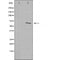 DF3472 staining  COLO205 cells by IF/ICC. The sample were fixed with PFA and permeabilized in 0.1% Triton X-100,then blocked in 10% serum for 45 minutes at 25¡ãC. The primary antibody was diluted at 1/200 and incubated with the sample for 1 hour at 37¡ãC. An  Alexa Fluor 594 conjugated goat anti-rabbit IgG (H+L) antibody(Cat.# S0006), diluted at 1/600, was used as secondary antibod