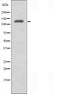 DF3473 staining HeLa by IF/ICC. The sample were fixed with PFA and permeabilized in 0.1% Triton X-100,then blocked in 10% serum for 45 minutes at 25¡ãC. The primary antibody was diluted at 1/200 and incubated with the sample for 1 hour at 37¡ãC. An  Alexa Fluor 594 conjugated goat anti-rabbit IgG (H+L) Ab, diluted at 1/600, was used as the secondary antibod