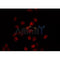 AF0353 staining Hela by IF/ICC. The sample were fixed with PFA and permeabilized in 0.1% Triton X-100,then blocked in 10% serum for 45 minutes at 25¡ãC. The primary antibody was diluted at 1/200 and incubated with the sample for 1 hour at 37¡ãC. An  Alexa Fluor 594 conjugated goat anti-rabbit IgG (H+L) Ab, diluted at 1/600, was used as the secondary antibod