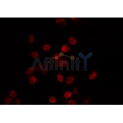 AF0353 staining Hela by IF/ICC. The sample were fixed with PFA and permeabilized in 0.1% Triton X-100,then blocked in 10% serum for 45 minutes at 25¡ãC. The primary antibody was diluted at 1/200 and incubated with the sample for 1 hour at 37¡ãC. An  Alexa Fluor 594 conjugated goat anti-rabbit IgG (H+L) Ab, diluted at 1/600, was used as the secondary antibod