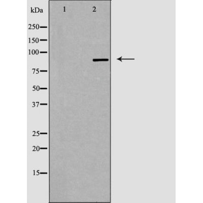 DF3475 staining COLO by IF/ICC. The sample were fixed with PFA and permeabilized in 0.1% Triton X-100,then blocked in 10% serum for 45 minutes at 25¡ãC. The primary antibody was diluted at 1/200 and incubated with the sample for 1 hour at 37¡ãC. An  Alexa Fluor 594 conjugated goat anti-rabbit IgG (H+L) Ab, diluted at 1/600, was used as the secondary antibod