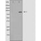DF3475 staining COLO by IF/ICC. The sample were fixed with PFA and permeabilized in 0.1% Triton X-100,then blocked in 10% serum for 45 minutes at 25¡ãC. The primary antibody was diluted at 1/200 and incubated with the sample for 1 hour at 37¡ãC. An  Alexa Fluor 594 conjugated goat anti-rabbit IgG (H+L) Ab, diluted at 1/600, was used as the secondary antibod