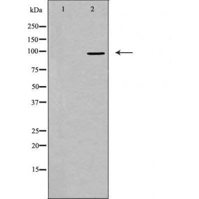 DF3481 staining LOVO by IF/ICC. The sample were fixed with PFA and permeabilized in 0.1% Triton X-100,then blocked in 10% serum for 45 minutes at 25¡ãC. The primary antibody was diluted at 1/200 and incubated with the sample for 1 hour at 37¡ãC. An  Alexa Fluor 594 conjugated goat anti-rabbit IgG (H+L) Ab, diluted at 1/600, was used as the secondary antibod