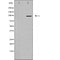 DF3481 staining LOVO by IF/ICC. The sample were fixed with PFA and permeabilized in 0.1% Triton X-100,then blocked in 10% serum for 45 minutes at 25¡ãC. The primary antibody was diluted at 1/200 and incubated with the sample for 1 hour at 37¡ãC. An  Alexa Fluor 594 conjugated goat anti-rabbit IgG (H+L) Ab, diluted at 1/600, was used as the secondary antibod