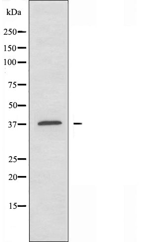 DF3482 staining COLO205 by IF/ICC. The sample were fixed with PFA and permeabilized in 0.1% Triton X-100,then blocked in 10% serum for 45 minutes at 25¡ãC. The primary antibody was diluted at 1/200 and incubated with the sample for 1 hour at 37¡ãC. An  Alexa Fluor 594 conjugated goat anti-rabbit IgG (H+L) Ab, diluted at 1/600, was used as the secondary antibod
