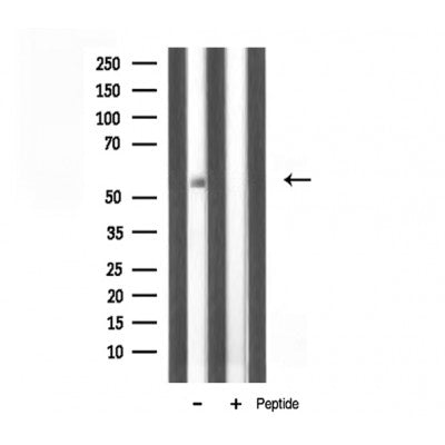 DF3483 staining Hela by IF/ICC. The sample were fixed with PFA and permeabilized in 0.1% Triton X-100,then blocked in 10% serum for 45 minutes at 25¡ãC. The primary antibody was diluted at 1/200 and incubated with the sample for 1 hour at 37¡ãC. An  Alexa Fluor 594 conjugated goat anti-rabbit IgG (H+L) Ab, diluted at 1/600, was used as the secondary antibod