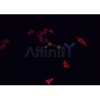 AF0354 staining A-431 cells by IF/ICC. The sample were fixed with PFA and permeabilized in 0.1% Triton X-100,then blocked in 10% serum for 45 minutes at 25¡ãC. The primary antibody was diluted at 1/200 and incubated with the sample for 1 hour at 37¡ãC. An  Alexa Fluor 594 conjugated goat anti-rabbit IgG (H+L) antibody(Cat.# S0006), diluted at 1/600, was used as secondary antibod