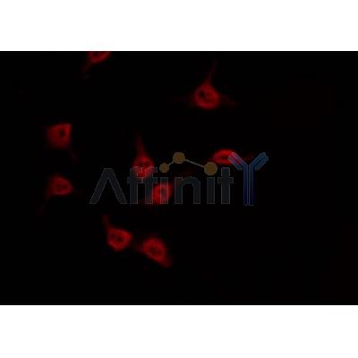 Western blot analysis of extracts from mouse brain, using DYR1B Antibody.