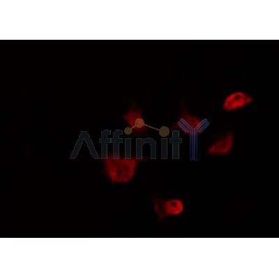 Western blot analysis of extracts from 293, using EID1 Antibody. Lane 1 was treated with the antigen-specific peptide.