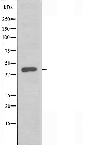 DF3492 staining Hela cells by IF/ICC. The sample were fixed with PFA and permeabilized in 0.1% Triton X-100,then blocked in 10% serum for 45 minutes at 25¡ãC. The primary antibody was diluted at 1/200 and incubated with the sample for 1 hour at 37¡ãC. An  Alexa Fluor 594 conjugated goat anti-rabbit IgG (H+L) antibody(Cat.# S0006), diluted at 1/600, was used as secondary antibod