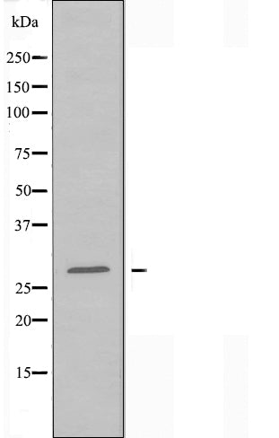 DF3494 staining HeLa cells by IF/ICC. The sample were fixed with PFA and permeabilized in 0.1% Triton X-100,then blocked in 10% serum for 45 minutes at 25¡ãC. The primary antibody was diluted at 1/200 and incubated with the sample for 1 hour at 37¡ãC. An  Alexa Fluor 594 conjugated goat anti-rabbit IgG (H+L) antibody(Cat.# S0006), diluted at 1/600, was used as secondary antibod