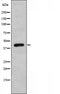 DF3496 staining HepG2 by IF/ICC. The sample were fixed with PFA and permeabilized in 0.1% Triton X-100,then blocked in 10% serum for 45 minutes at 25¡ãC. The primary antibody was diluted at 1/200 and incubated with the sample for 1 hour at 37¡ãC. An  Alexa Fluor 594 conjugated goat anti-rabbit IgG (H+L) Ab, diluted at 1/600, was used as the secondary antibod
