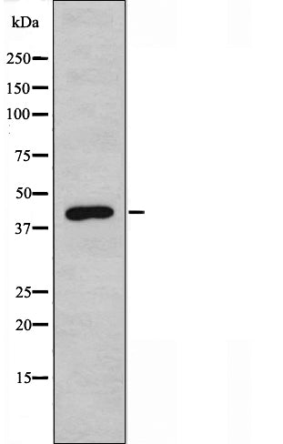 DF3496 staining HepG2 by IF/ICC. The sample were fixed with PFA and permeabilized in 0.1% Triton X-100,then blocked in 10% serum for 45 minutes at 25¡ãC. The primary antibody was diluted at 1/200 and incubated with the sample for 1 hour at 37¡ãC. An  Alexa Fluor 594 conjugated goat anti-rabbit IgG (H+L) Ab, diluted at 1/600, was used as the secondary antibod