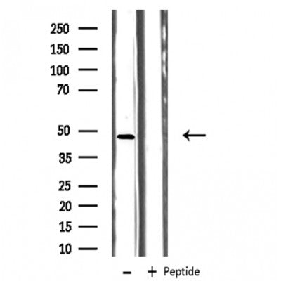 DF3497 at 1/100 staining Human liver cancer tissue by IHC-P. The sample was formaldehyde fixed and a heat mediated antigen retrieval step in citrate buffer was performed. The sample was then blocked and incubated with the antibody for 1.5 hours at 22¡ãC. An HRP conjugated goat anti-rabbit antibody was used as the secondary