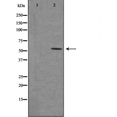 DF3501 staining Hela by IF/ICC. The sample were fixed with PFA and permeabilized in 0.1% Triton X-100,then blocked in 10% serum for 45 minutes at 25¡ãC. The primary antibody was diluted at 1/200 and incubated with the sample for 1 hour at 37¡ãC. An  Alexa Fluor 594 conjugated goat anti-rabbit IgG (H+L) Ab, diluted at 1/600, was used as the secondary antibod