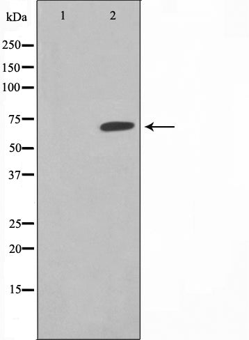 Western blot analysis on NIH-3T3 cell lysate using THRB Antibody,The lane on the left is treated with the antigen-specific peptide.