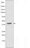 DF3504 staining  HeLa cells by IF/ICC. The sample were fixed with PFA and permeabilized in 0.1% Triton X-100,then blocked in 10% serum for 45 minutes at 25¡ãC. The primary antibody was diluted at 1/200 and incubated with the sample for 1 hour at 37¡ãC. An  Alexa Fluor 594 conjugated goat anti-rabbit IgG (H+L) antibody(Cat.