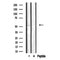 Western blot analysis of extracts from mouse brain, using ADRA1A Antibody. Lane 1 was treated with the antigen-specific peptide.