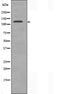 DF3508 at 1/100 staining Human liver cancer tissue by IHC-P. The sample was formaldehyde fixed and a heat mediated antigen retrieval step in citrate buffer was performed. The sample was then blocked and incubated with the antibody for 1.5 hours at 22¡ãC. An HRP conjugated goat anti-rabbit antibody was used as the secondary