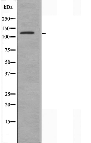 DF3508 at 1/100 staining Human liver cancer tissue by IHC-P. The sample was formaldehyde fixed and a heat mediated antigen retrieval step in citrate buffer was performed. The sample was then blocked and incubated with the antibody for 1.5 hours at 22¡ãC. An HRP conjugated goat anti-rabbit antibody was used as the secondary