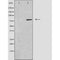 DF3509 staining 293 cells by IF/ICC. The sample were fixed with PFA and permeabilized in 0.1% Triton X-100,then blocked in 10% serum for 45 minutes at 25¡ãC. The primary antibody was diluted at 1/200 and incubated with the sample for 1 hour at 37¡ãC. An  Alexa Fluor 594 conjugated goat anti-rabbit IgG (H+L) antibody(Cat.