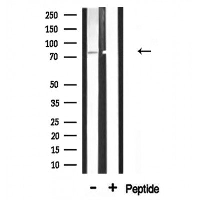 Western blot analysis of extracts from 293, using ADD3 Antibody.
