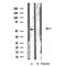 DF3511 staining  HT29 cells by IF/ICC. The sample were fixed with PFA and permeabilized in 0.1% Triton X-100,then blocked in 10% serum for 45 minutes at 25¡ãC. The primary antibody was diluted at 1/200 and incubated with the sample for 1 hour at 37¡ãC. An  Alexa Fluor 594 conjugated goat anti-rabbit IgG (H+L) antibody(Cat.