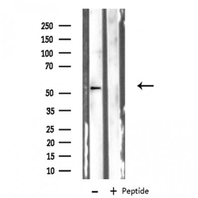 DF3511 staining  HT29 cells by IF/ICC. The sample were fixed with PFA and permeabilized in 0.1% Triton X-100,then blocked in 10% serum for 45 minutes at 25¡ãC. The primary antibody was diluted at 1/200 and incubated with the sample for 1 hour at 37¡ãC. An  Alexa Fluor 594 conjugated goat anti-rabbit IgG (H+L) antibody(Cat.