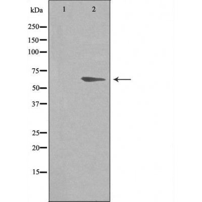 DF3512 staining HuvEc by IF/ICC. The sample were fixed with PFA and permeabilized in 0.1% Triton X-100,then blocked in 10% serum for 45 minutes at 25¡ãC. The primary antibody was diluted at 1/200 and incubated with the sample for 1 hour at 37¡ãC. An  Alexa Fluor 594 conjugated goat anti-rabbit IgG (H+L) Ab, diluted at 1/600, was used as the secondary antibod