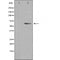 DF3512 staining HuvEc by IF/ICC. The sample were fixed with PFA and permeabilized in 0.1% Triton X-100,then blocked in 10% serum for 45 minutes at 25¡ãC. The primary antibody was diluted at 1/200 and incubated with the sample for 1 hour at 37¡ãC. An  Alexa Fluor 594 conjugated goat anti-rabbit IgG (H+L) Ab, diluted at 1/600, was used as the secondary antibod